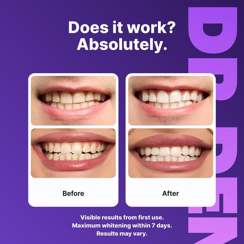 DRDENT Purple Teeth Whitening Strips - 21 Sessions of Enamel-Safe, Non-Sensitive, Peroxide-Free Whitening!